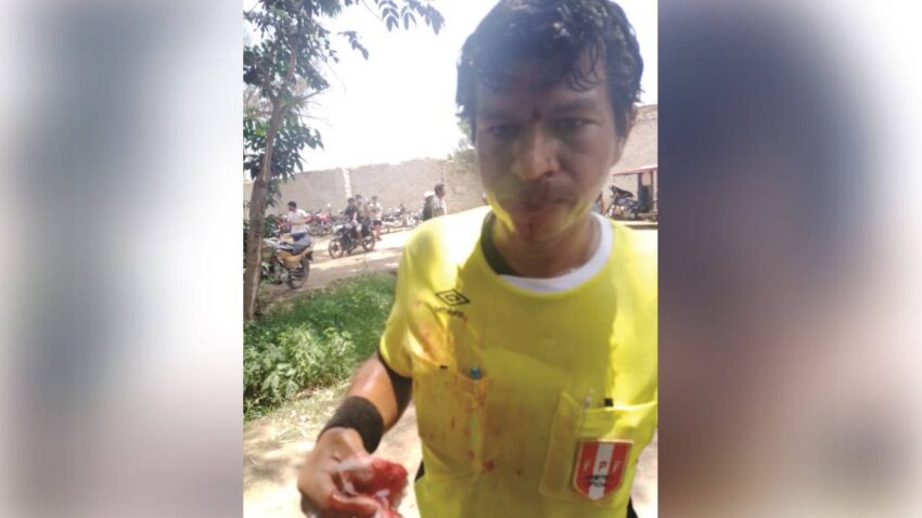 ÁRBITRO AGREDIDO EN CHICLAYO
